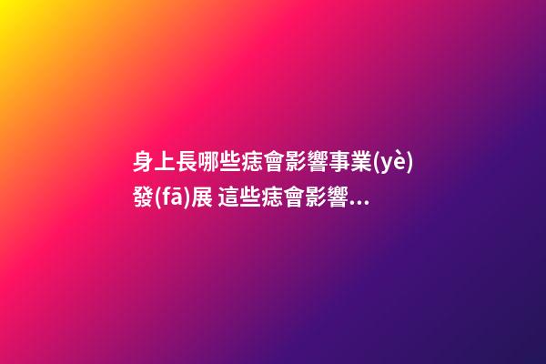 身上長哪些痣會影響事業(yè)發(fā)展 這些痣會影響事業(yè)運勢